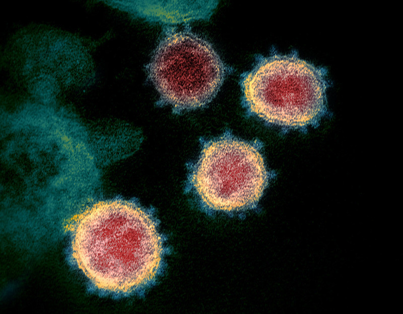 Novel Coronavirus SARS-CoV-2